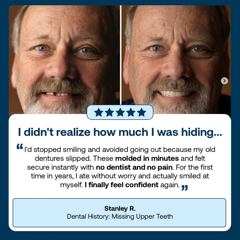 -👑-2026 Hot Sale Ends Today: 70% OFF! Custom Custom-Fit Full Functional DenturesMake you more confident – Made in the USA