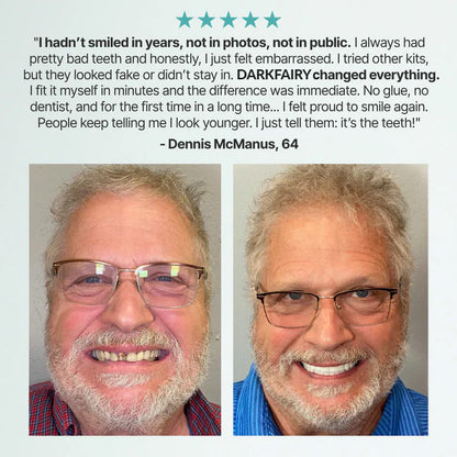 DarkFairy™ Custom-Fit Dentures — Designed for Comfort and a Natural-Looking Smile