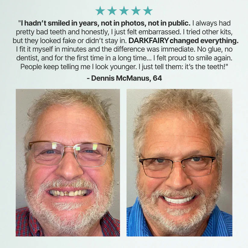 ✨Ends Today: 70% OFF! ✨2026 Bestselling Product🦷 Fit for a Fresh Smile, Say Goodbye to Wearing Discomfort!🌎