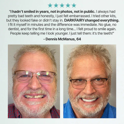 ✨Ends Today: 70% OFF! ✨2026 Bestselling Product🦷 Fit for a Fresh Smile, Say Goodbye to Wearing Discomfort!🌎