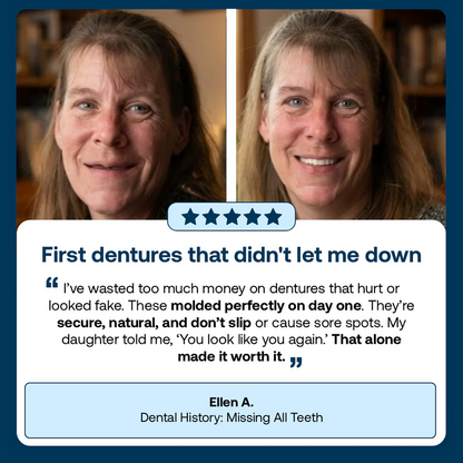 -👑2026 Hot Sale Ends Today: 70% OFF!  Custom Custom-Fit Full Functional DenturesMake you more confident – Made in the USA