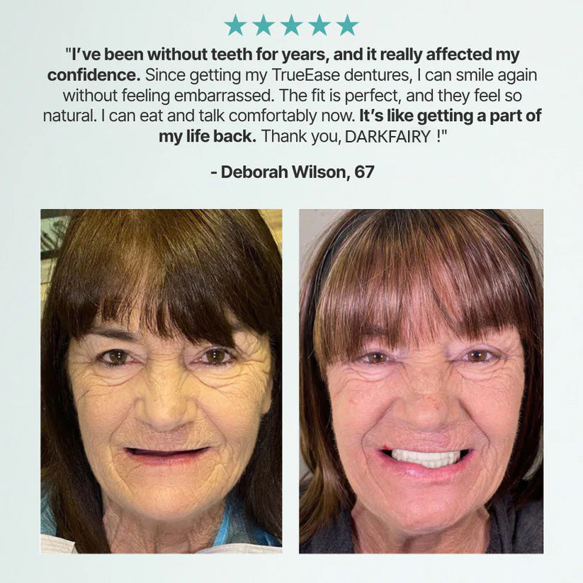 ✨Ends Today: 70% OFF! ✨2026 Bestselling Product🦷 Fit for a Fresh Smile, Say Goodbye to Wearing Discomfort!🌎