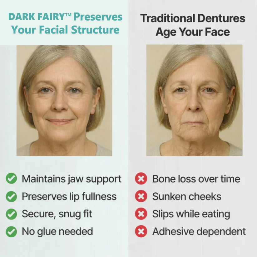 -👑2026 Hot Sale Ends Today: 70% OFF!  Custom Custom-Fit Full Functional DenturesMake you more confident – Made in the USA