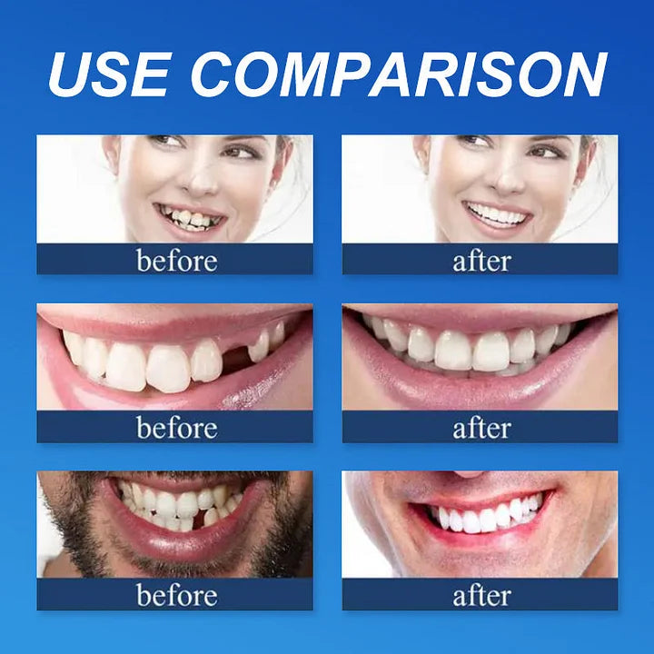 -Ends Today: 75% OFF! ⏰DarkFairy™ Medical Full Denture with Strong Suctiond Custom-Fit Full Functional Dentures🦷