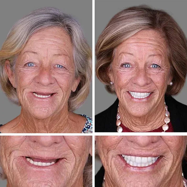 -🏆Ends Today: 70% OFF!  🏆2026 Bestselling Product🦷 Fit for a Fresh Smile, Say Goodbye to Wearing Discomfort!🌎