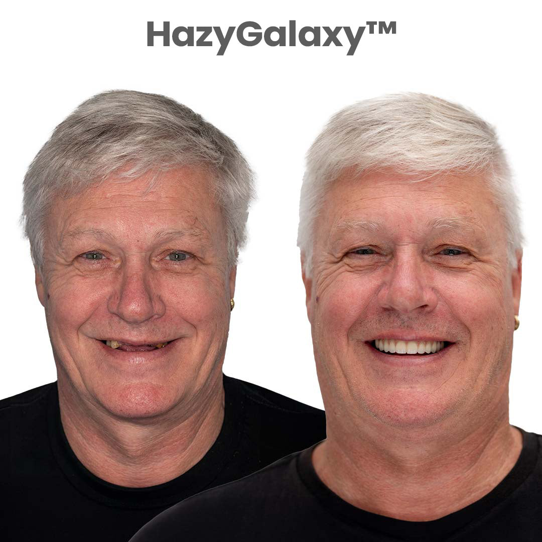 -🦷 HazyGalaxy™ Custom-Fit Dentures ⏰ ENDS TODAY   70% OFF | Smile with Confidence