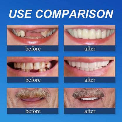 -🏆Ends Today: 70% OFF!  🏆2026 Bestselling Product🦷 Fit for a Fresh Smile, Say Goodbye to Wearing Discomfort!🌎